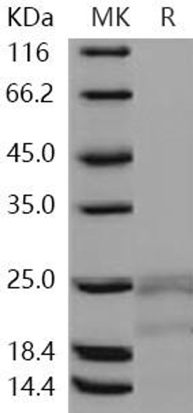 Human Interferon gamma/IFNG Recombinant Protein  (RPES0949)