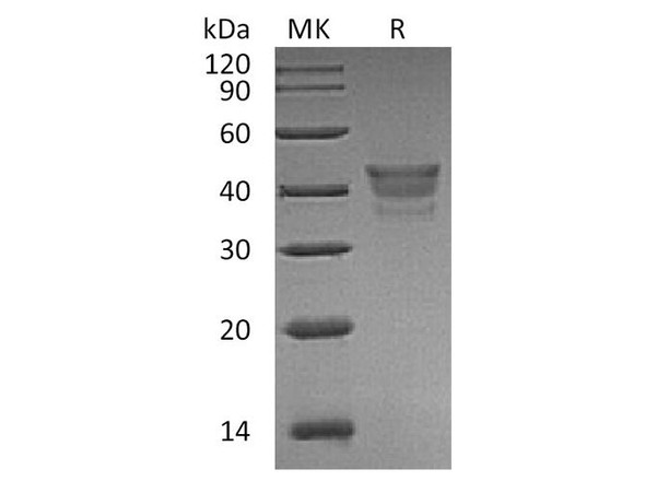 Human METAP1 Recombinant Protein (RPES0959)