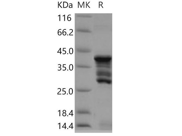 Human CD247/CD3-ZETA Recombinant Protein (RPES0981)