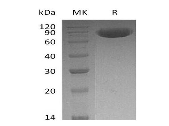 Human OX-2/MOX1/CD200 Recombinant Protein (RPES0990)