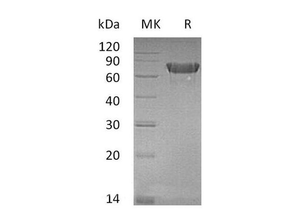 Mouse OX40/TNFRSF4 Recombinant Protein (RPES0997)