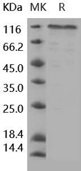 Human COMP Recombinant Protein (RPES1000)