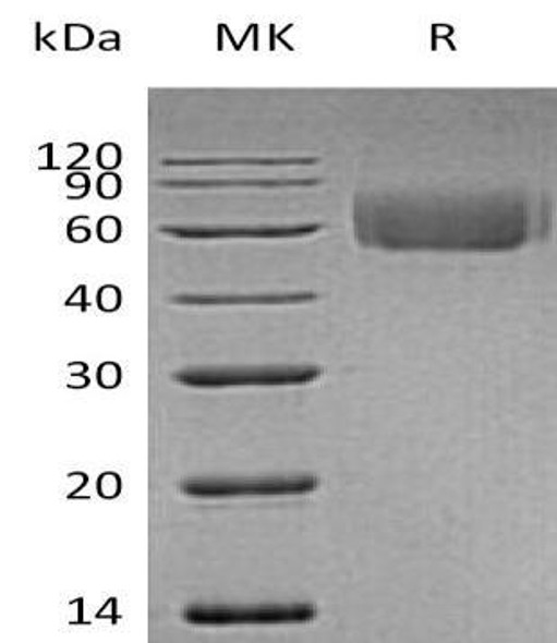 Human ILRL2 Recombinant Protein (RPES1039)