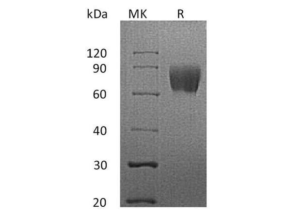 Human LFA-3/CD58 Recombinant Protein (RPES1046)