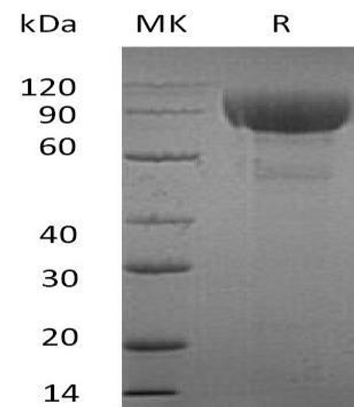 Human ILRL2 Recombinant Protein (RPES1057)