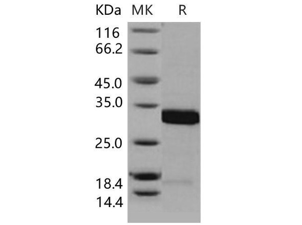Mouse 14-3-3 sigma/YWHAS Recombinant Protein (RPES1072)