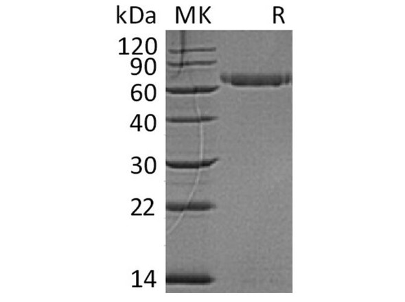 Human LAG3/CD223 Recombinant Protein (RPES1083)