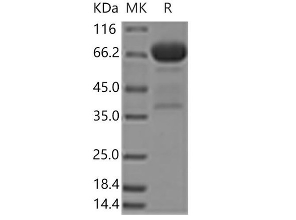 Human Mesothelin/MSLN Recombinant Protein (RPES1086)