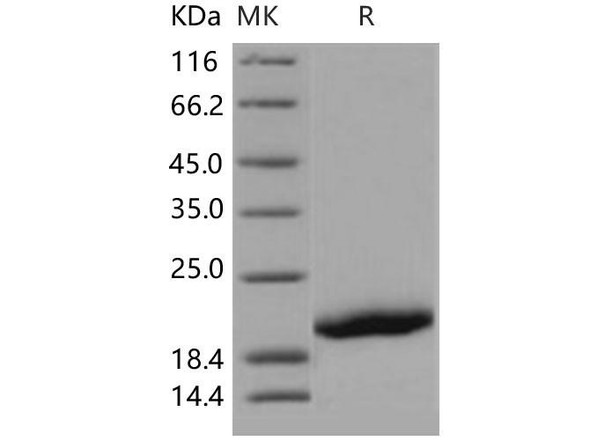 Human GP1BB/CD42c Recombinant Protein (RPES1088)