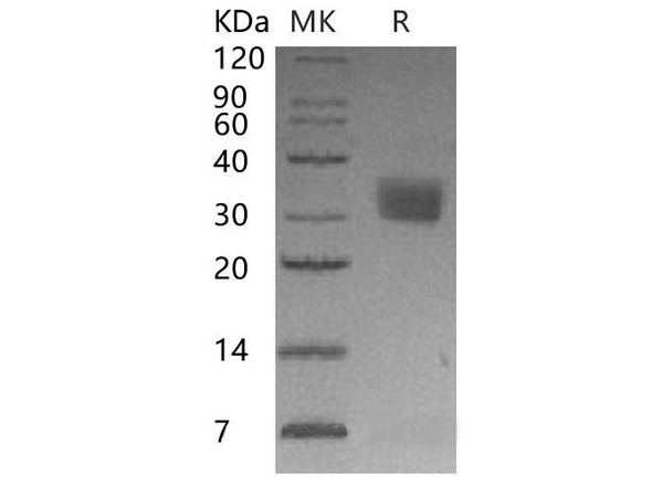 Mouse Mesothelin/MSLN Recombinant Protein (RPES1103)