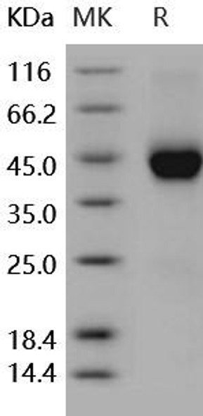 Human Cystatin 7/CST7 Recombinant Protein (RPES1108)
