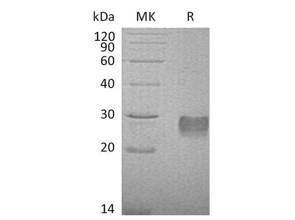 Mouse IGFBP6/IGFBP-6 Recombinant Protein (RPES1117)