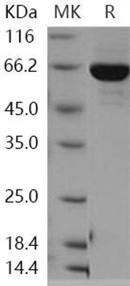 Human PTPN12 Recombinant Protein (RPES1125)