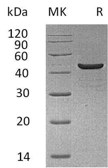 Creatine Kinase, Muscle/CKM Recombinant Protein (RPES1132)