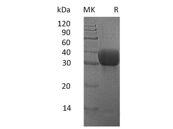 Mouse MGL2/CD301b Recombinant Protein (RPES1142)