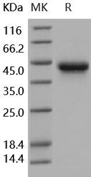 Human IL2Ra/CD25 Recombinant Protein (RPES1147)