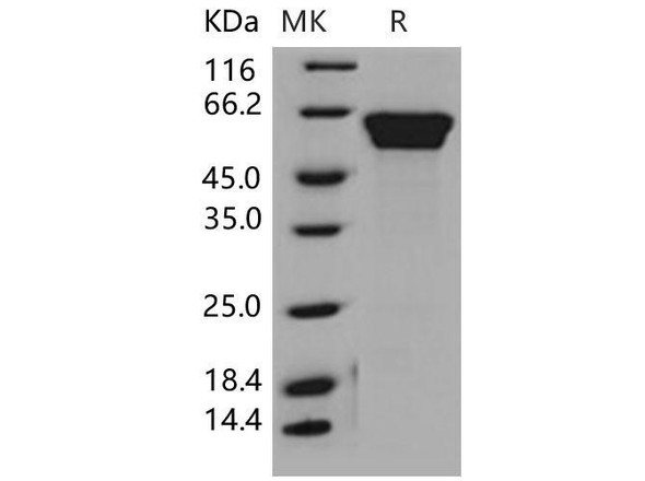 Mouse Fetuin-B/FETUB Recombinant Protein (RPES1149)