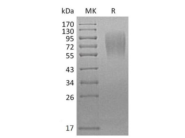 Mouse LAMP1/CD107a Recombinant Protein (RPES1161)