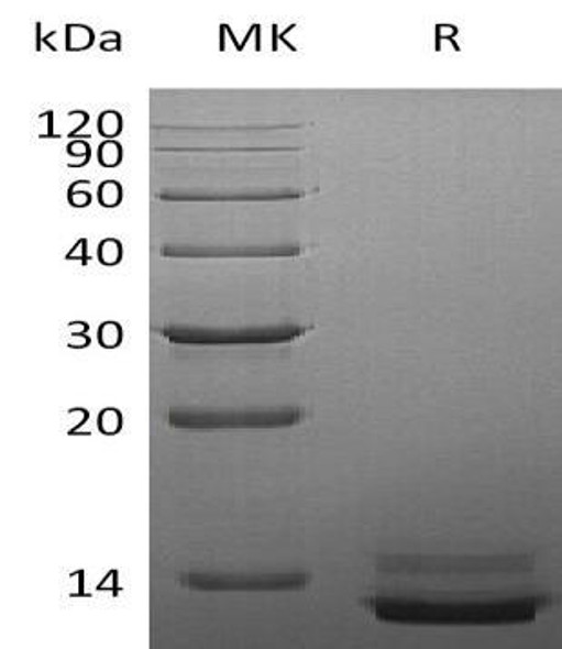 Human PPY Recombinant Protein (RPES1172)