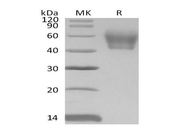Mouse IL1R2/CD121b Recombinant Protein (RPES1175)