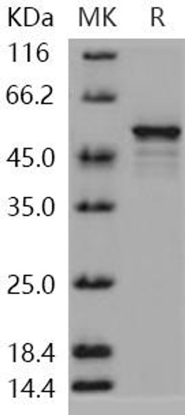 Human DOT1L/KMT4 Recombinant Protein (RPES1182)