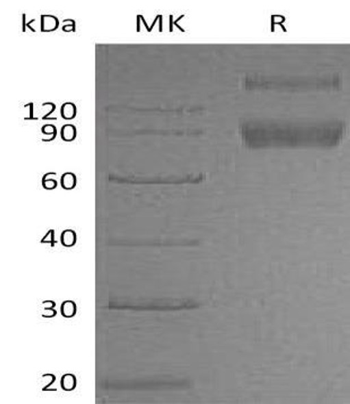 Mouse IL1R2/CD121b Recombinant Protein (RPES1193)