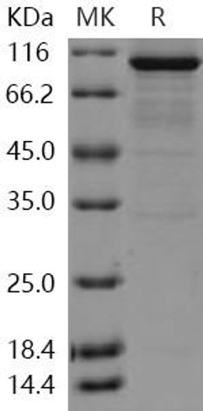 Human DCAMKL1 Recombinant Protein (RPES1198)