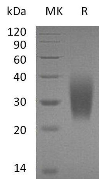 Human PTH1R Recombinant Protein (RPES1209)