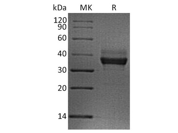 Human LILRB4/CD85k/ILT3 Recombinant Protein (RPES1214)