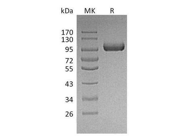 Mouse LRIG1 Recombinant Protein (RPES1215)