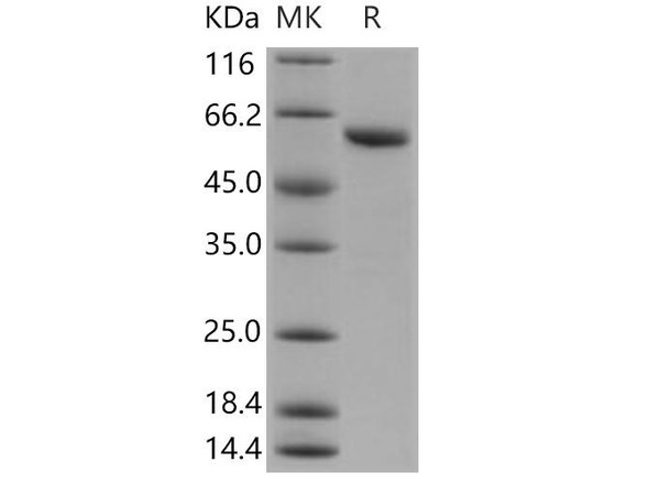 Human TXNRD1/TRXR1 Recombinant Protein (RPES1217)