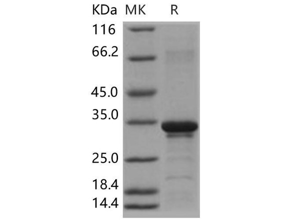 Beta-amyloid 38/Beta-APP38 Recombinant Protein (RPES1233)