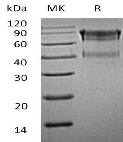 Mouse IL15RA/CD215 Recombinant Protein (RPES1261)