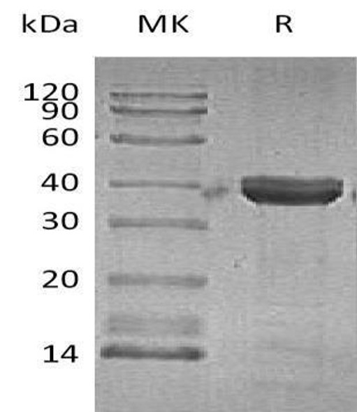 Human Cathepsin Z Recombinant Protein (RPES1271)