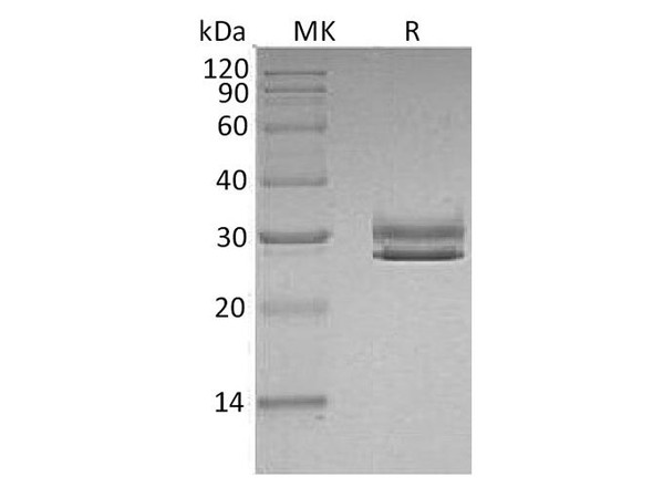 Human JAM-A/F11R Recombinant Protein (RPES1283)