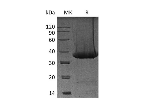 Mouse Kallikrein 1/KLK1 Recombinant Protein (RPES1284)