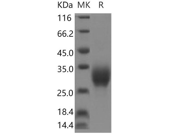 Human Interleukin9/IL9 Recombinant Protein (RPES1286)