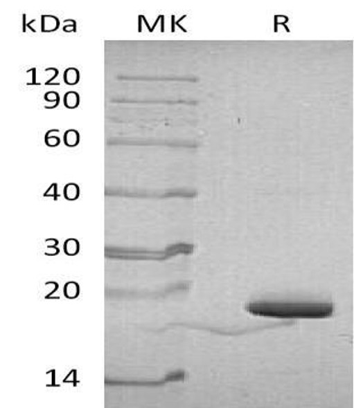 Human Parvulin4/PIN4 Recombinant Protein (RPES1296)