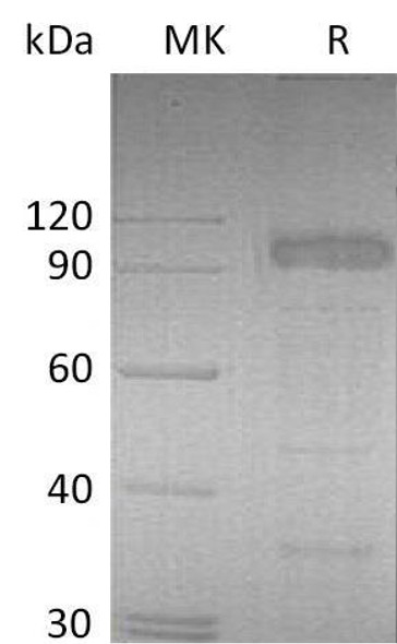 Mouse IL-23 Receptor/IL-23R Recombinant Protein (RPES1299)