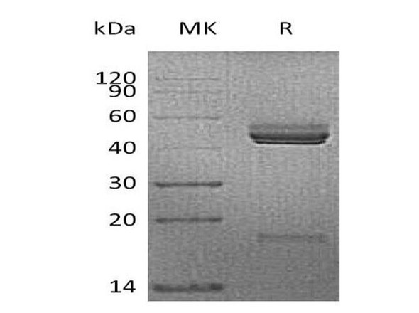 Mouse IL-23 Recombinant Protein (RPES1303)