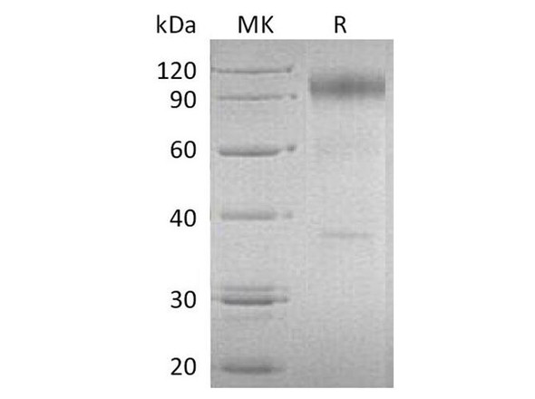 Human IL-23 Recetor/IL-23R Recombinant Protein (RPES1313)