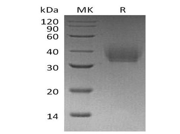 Mouse IL-21R Recombinant Protein (RPES1321)