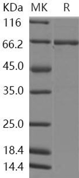 Human ABL1/JTK7/p150 Recombinant Protein (RPES1322)