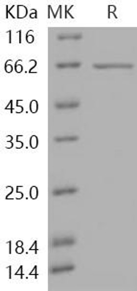 Human HDAC3 Recombinant Protein (RPES1342)