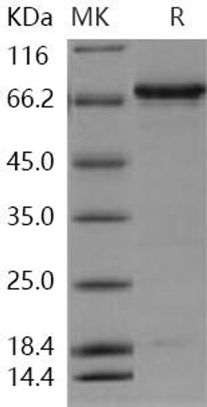 Human Insulin Receptor/INSR Recombinant Protein (RPES1359)