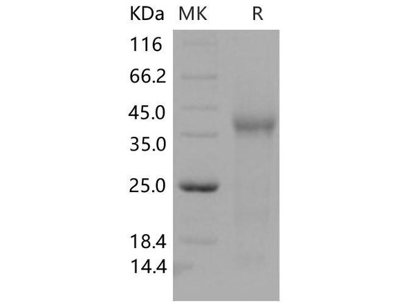 Mouse TGFBR3/Betaglycan Recombinant Protein (RPES1365)