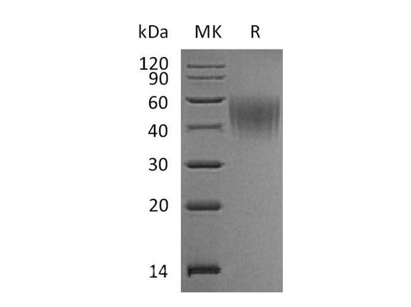 Mouse IL2Ra/CD25 Recombinant Protein (RPES1377)