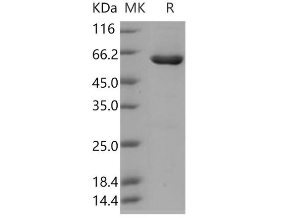 Human CSNK2A2/CK2A2 Recombinant Protein (RPES1378)