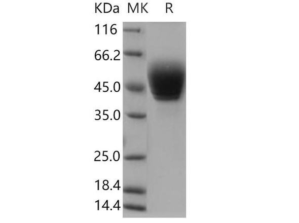 Human TSPAN1 Recombinant Protein (RPES1379)