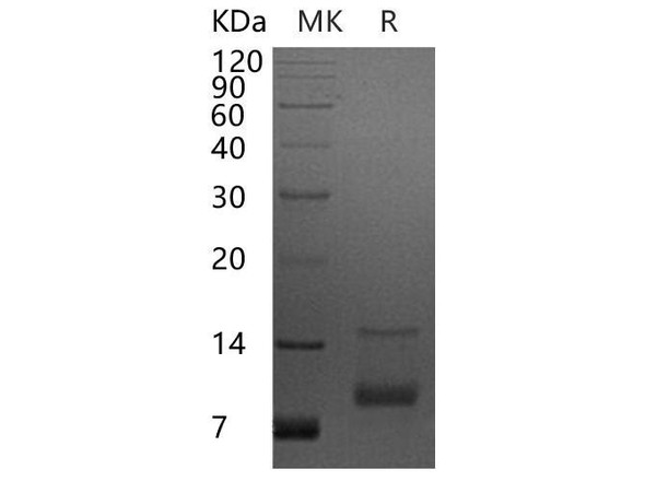 Human CXCL7/NAP-2 Recombinant Protein (RPES1406)